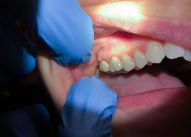 Best After-Hours Dental Trauma Care in New Johnsonville, TN