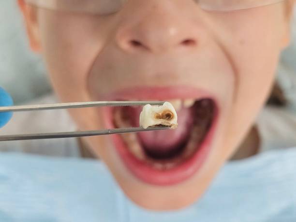 Best Emergency Gum Treatment in New Johnsonville, TN