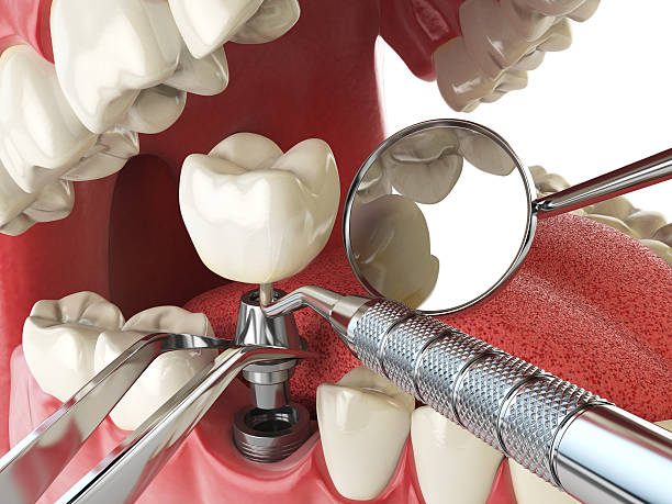 Best Emergency Treatment for Dental Infections or Abscesses in New Johnsonville, TN